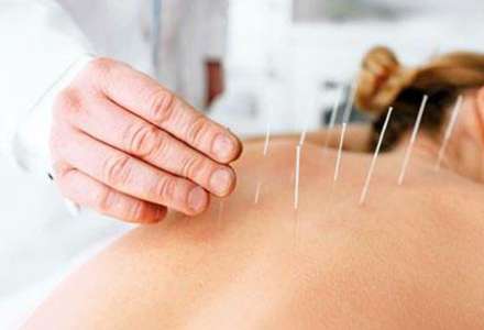 Akupunktura podpoří zdraví i psychiku